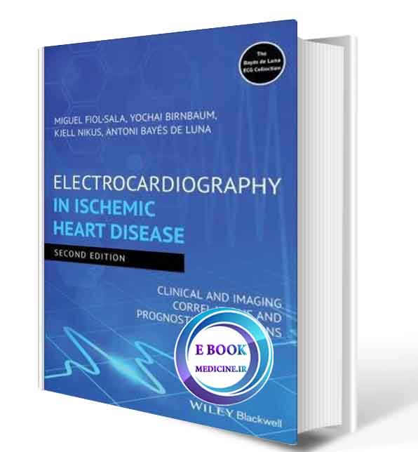 دانلود کتابElectrocardiography in Ischemic Heart Disease: Clinical and Imaging Correlations and Prognostic Implications 2020(Original PDF) 